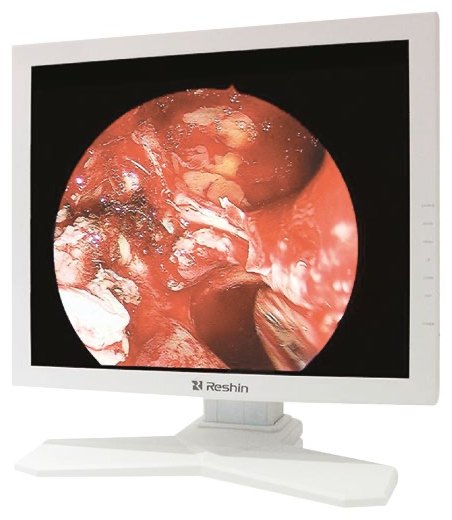 MS190S — Monitor Médico Full HD 19"